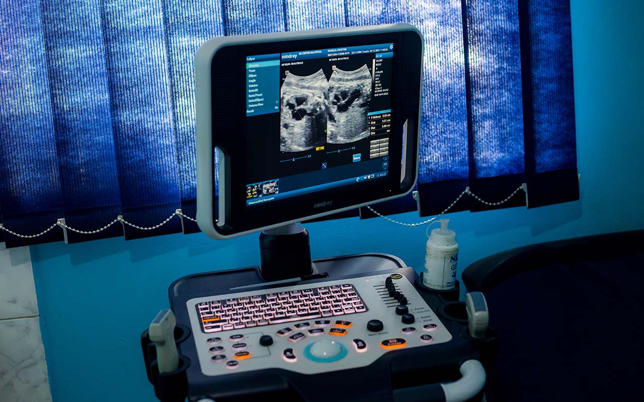 Ultrasound Scans Image